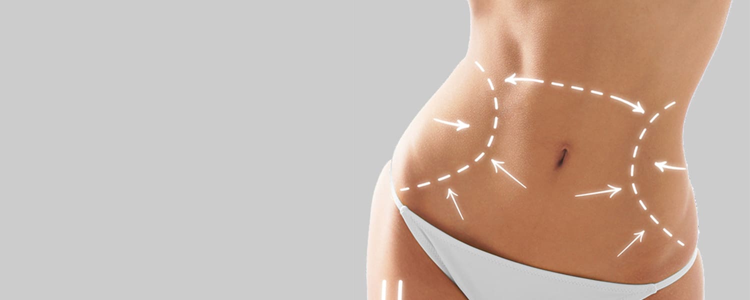 Humen body contouring Humen body contouring