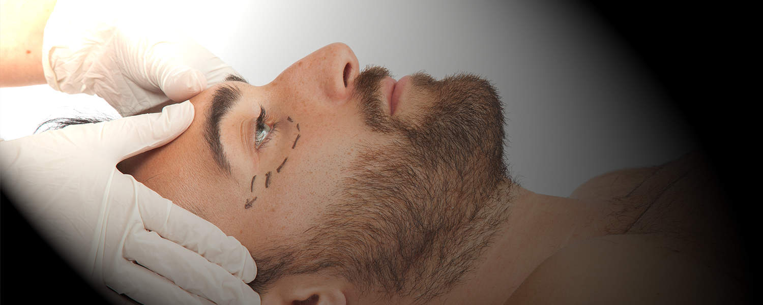 face surgery face surgery